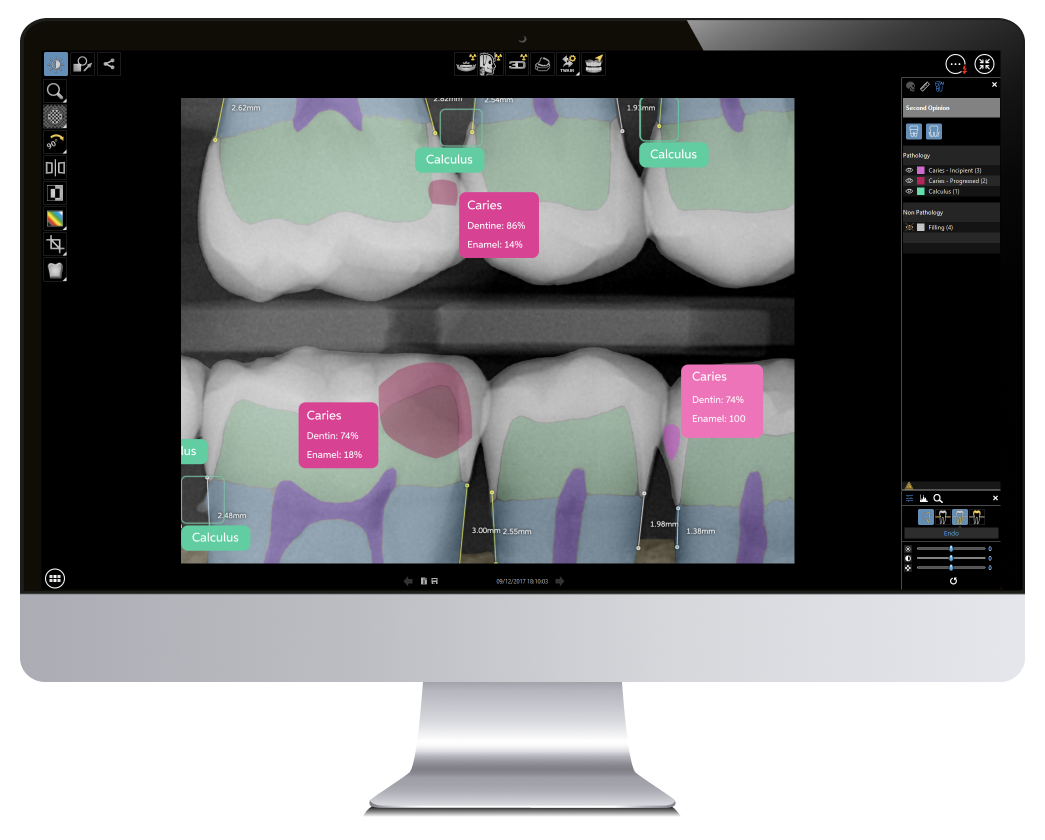 Carestream_Pearl-iMac_Small Carestream_Pearl-iMac_Small