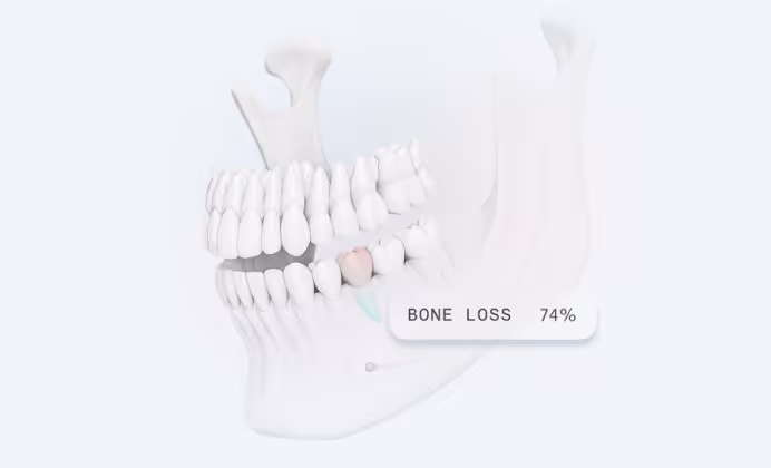 SO3D-HubspotLP